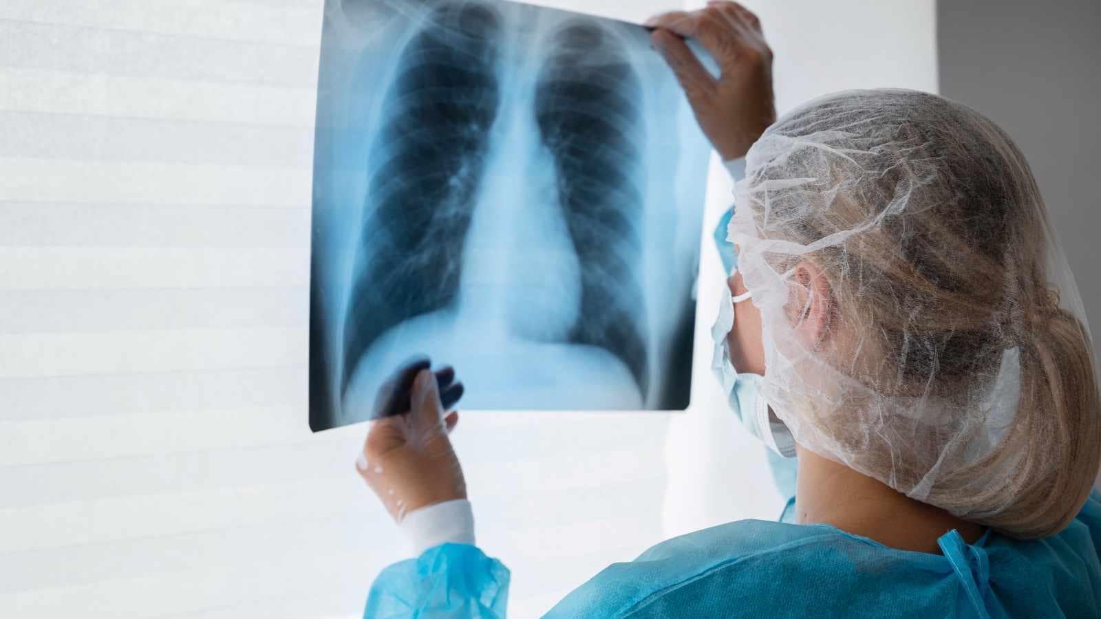 TB burden dips but India far from elimination target, says global TB report: Goal of reducing 50% of cases, 75% of deaths since 2015 seem distant