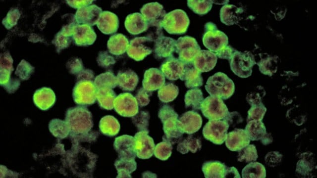 brain eating amoeba