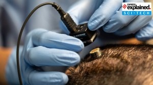 How scientists built a password-protected mind-reading brain implant