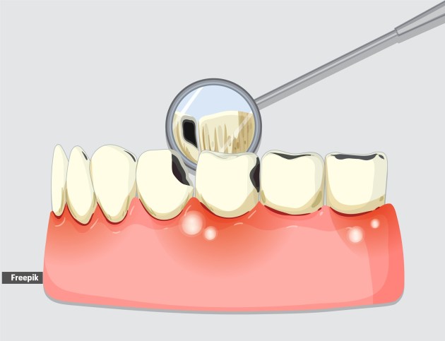 It is said that the structural adaptability and mineral ion-binding affinity of keratin help it form a microscopic scaffold, which interacts with minerals from our saliva to create a crystal-like layer that mimics enamel