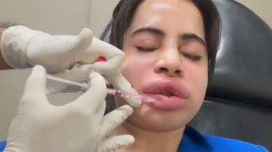 From rhinoplasty to liposuction, explore how India is becoming the new destination for beauty transformations.