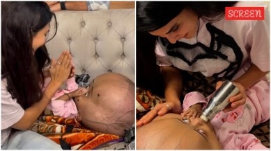 Jacqueline Fernandez meets kid suffering from a rare condition.