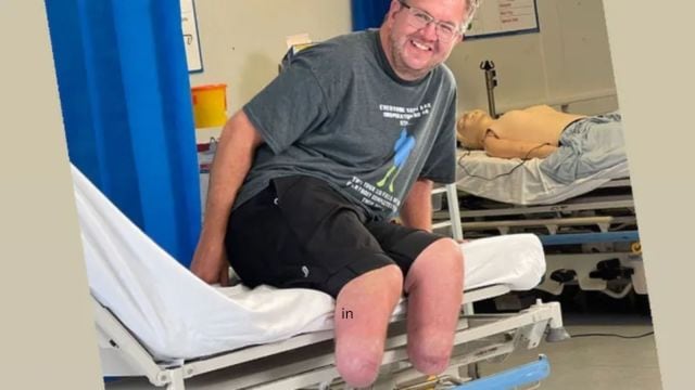 A fetish, frozen legs and a 5 crore scam: how an NHS doctor fooled insurers with self-amputation
