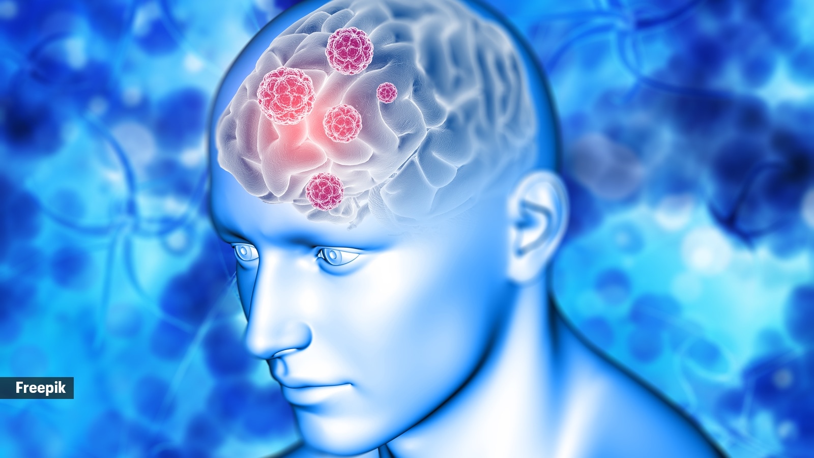 Neurosurgeon says a simple blood test can predict brain diseases years before symptoms; here’s everything you need to know