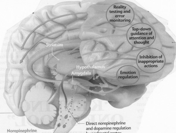 ADHD arises from maldevelopment in brain. (Wikimedia Commons) 