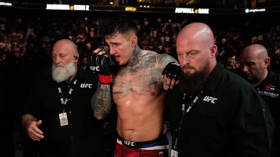 Aspinall was taken to hospital following the fight, and after flying back to England visited an eye specialist in Manchester. (AP Photo)