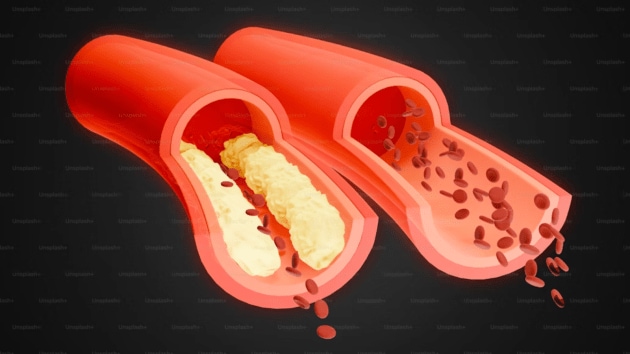 health