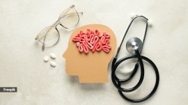 What is a silent stroke?