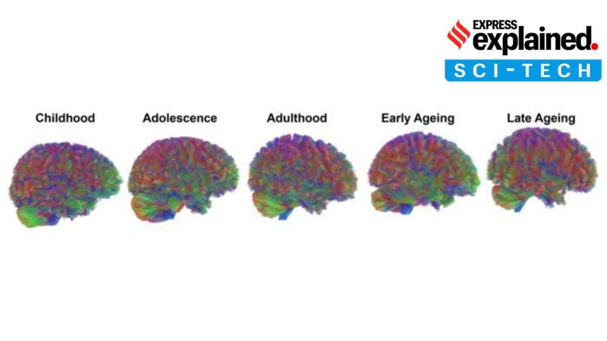 Human brain ageing study