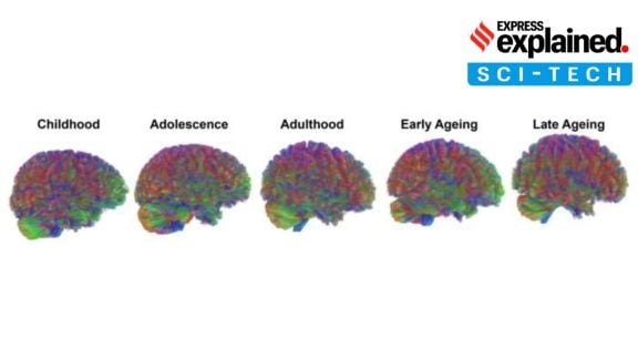 Human brain ageing study