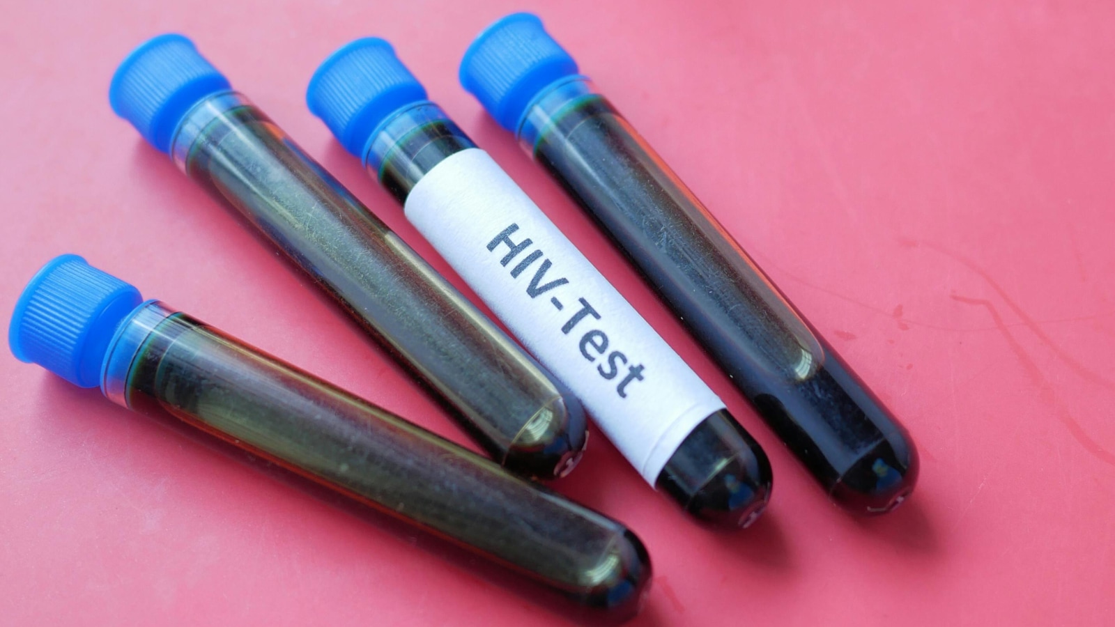 Study calls for tailored treatments for regional HIV variations