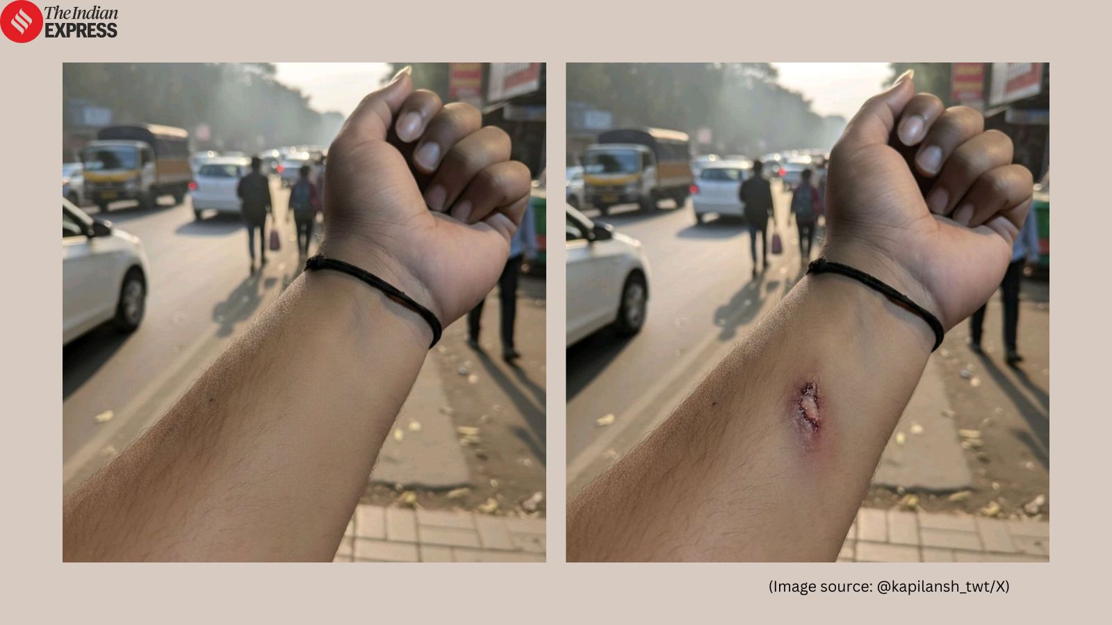 ‘AI just broke HR…’: Employee uses Google’s Nano Banana AI tool to fake injury, HR approves paid leave; ignites debate