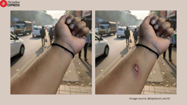 Employee uses Google’s Nano Banana AI tool to fake injury