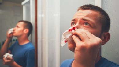 nose bleed