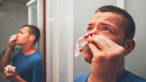 nose bleed