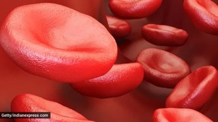 sickle cell disease