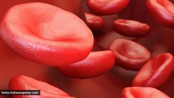 sickle cell disease