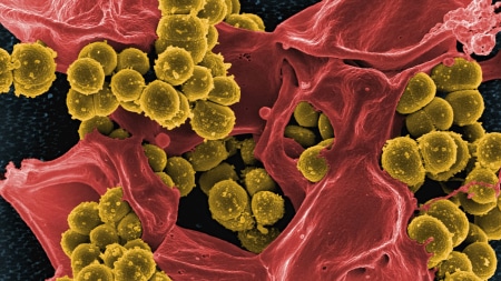 Antibiotic-resistance