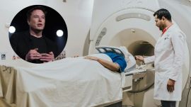 Do you really need an MRI if you feel fine?