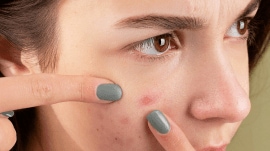 New research from her team shows that the FSH-iB test offers 100% accuracy in diagnosing gonadotropin deficiency, improving care for affected children.