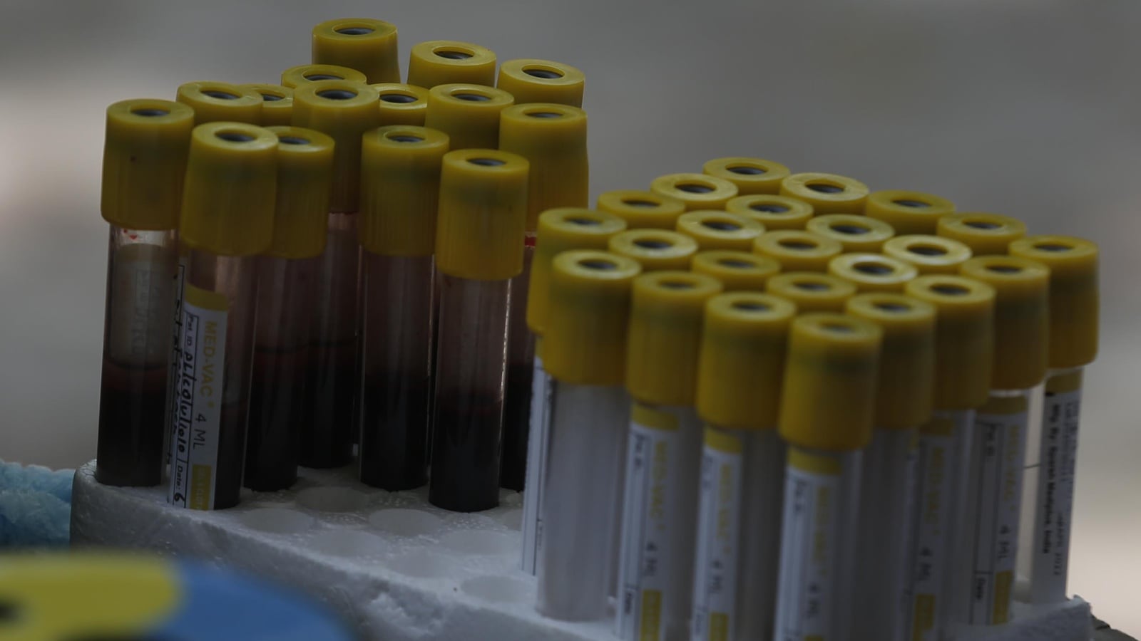 blood samples