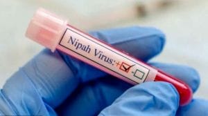 Nipah usually presents as fever and swelling of the brain and can be highly fatal. (File Photo)