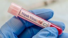 Nipah virus