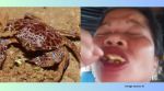 Devil crabs are considered among the most poisonous crabs in the Philippines