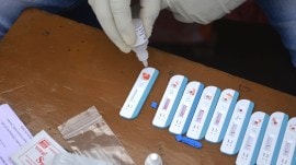 HIV test