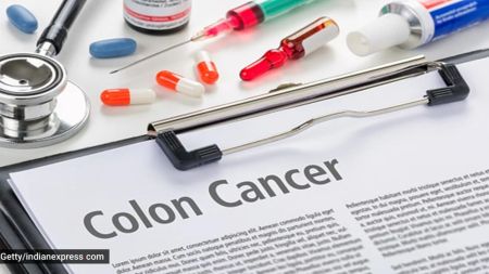Colorectal cancer