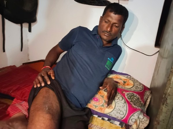 Villager Lakshman Mane from Mandur village, attacked by Bison. (Express Photo)