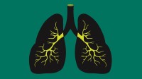 For TB-free India, we need science, and the power of jan bhagidari