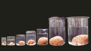 IIT Madras brain atlas