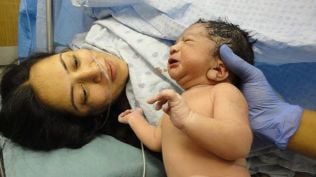 Birth Anomalies Network of India launch, birth defects, birth anomaly,