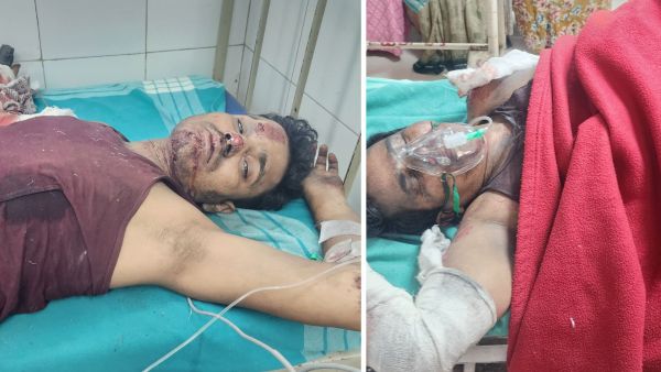 The factory workers undergoing treatment following the blast the Surat factory unit