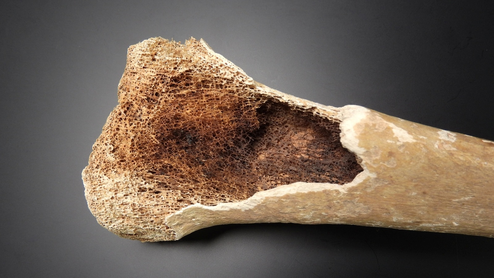 bone