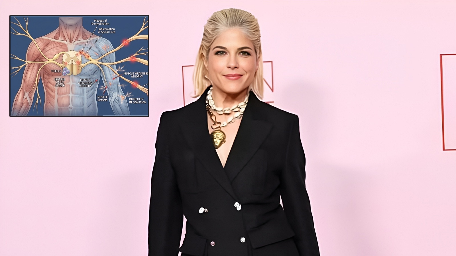 Selma Blair shares health update, says she’s ‘relapse-free’ amid Multiple Sclerosis diagnosis: ‘Going out isn’t so scary’