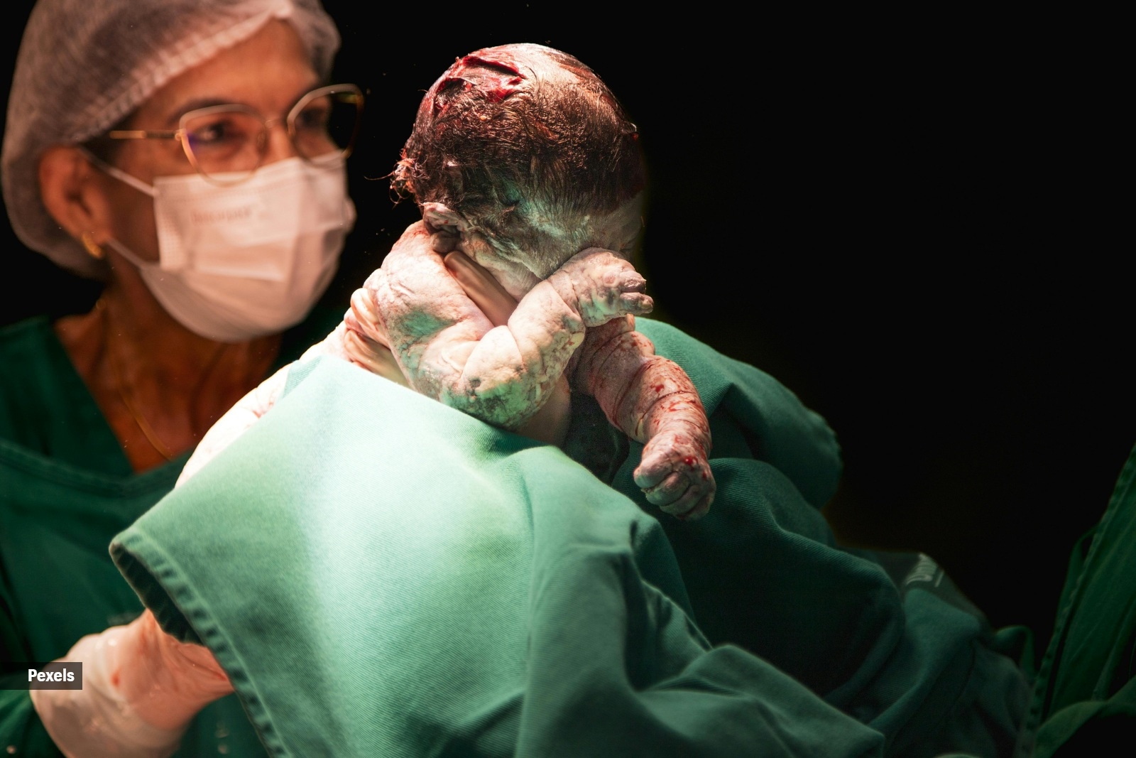 cesarean