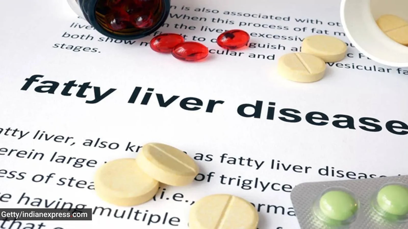 fatty liver 