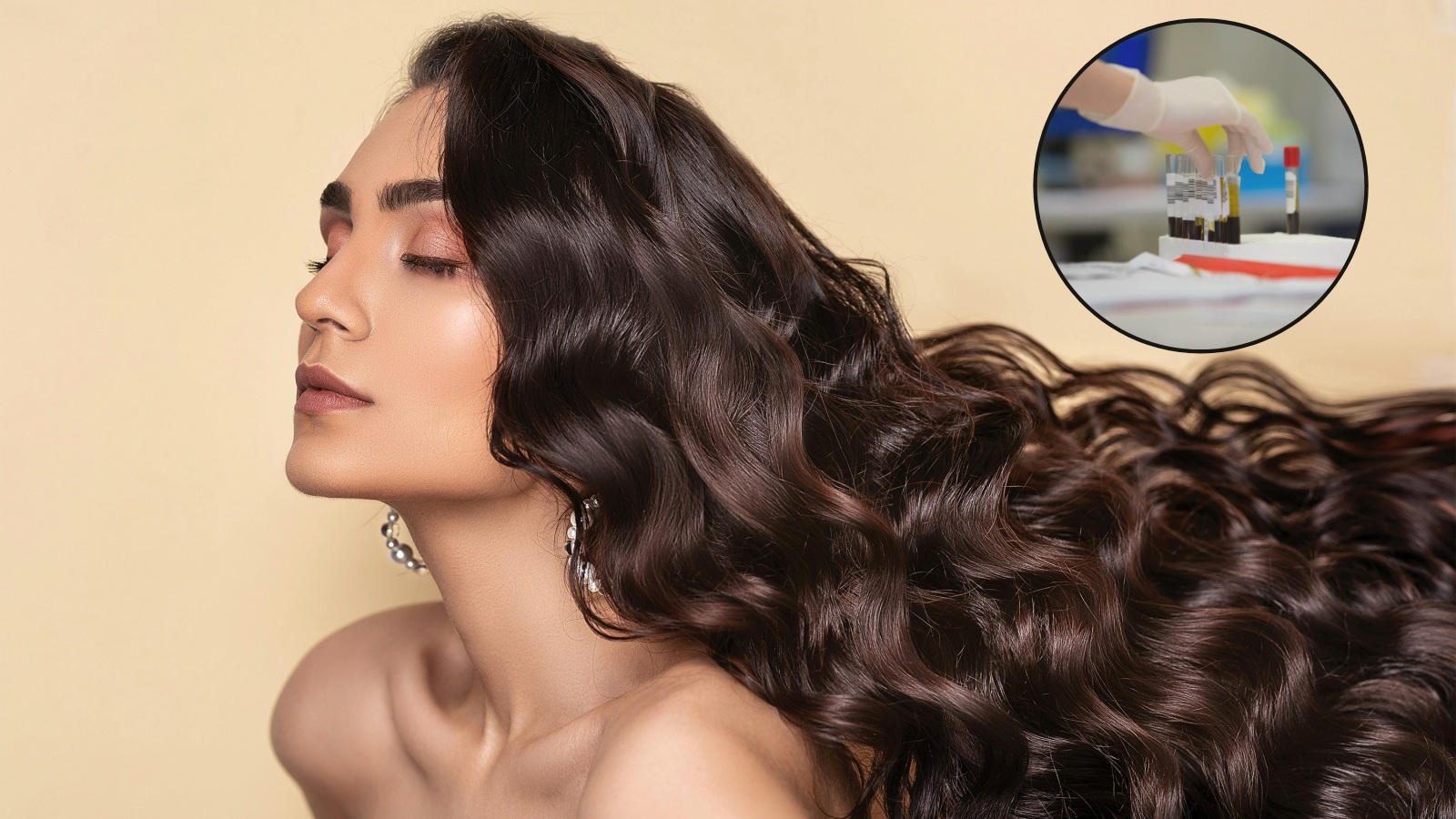Internet suggests these blood tests can ‘save your hair’; here’s what a dermatologist says