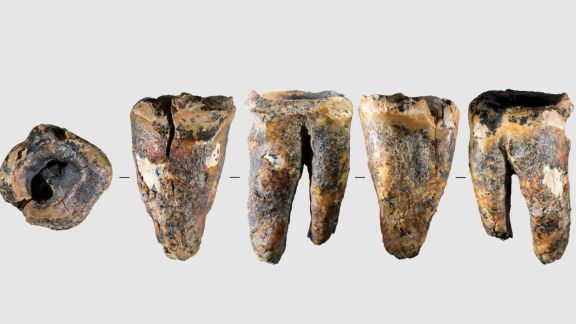 Researchers believe a 59,000-year-old Neanderthal tooth discovered in Siberia may contain the earliest known evidence of dentistry, predating previous examples by more than 40,000 years. (Image: Reuters)