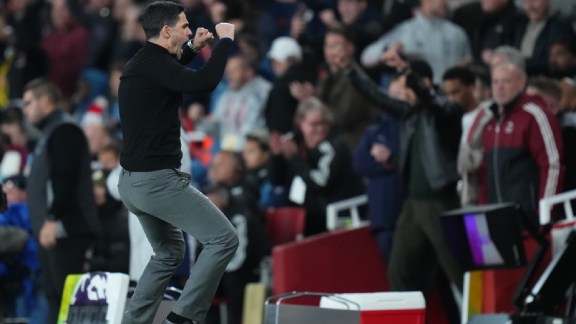 Mikel Arteta Arsenal