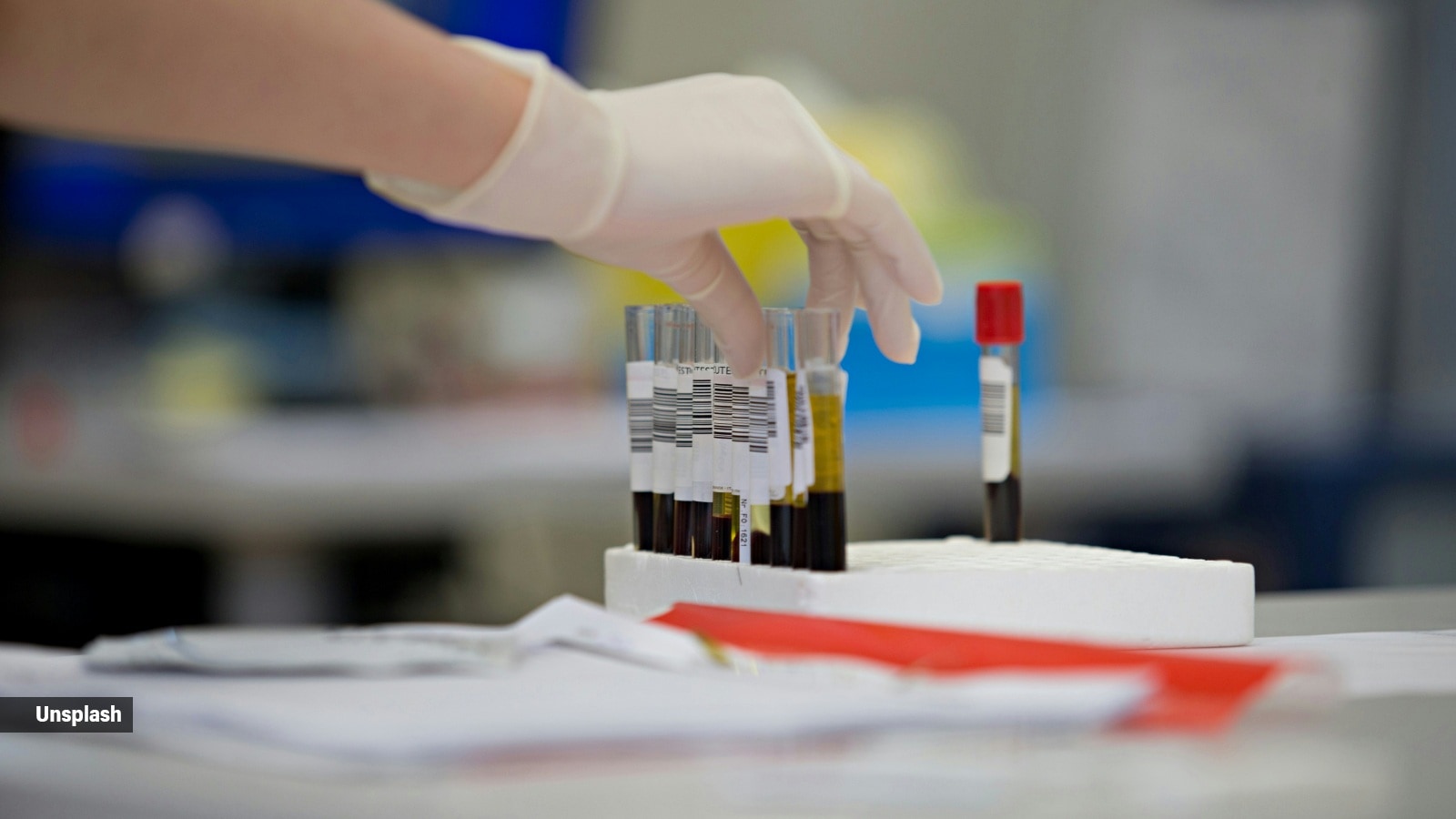 Thalassemia