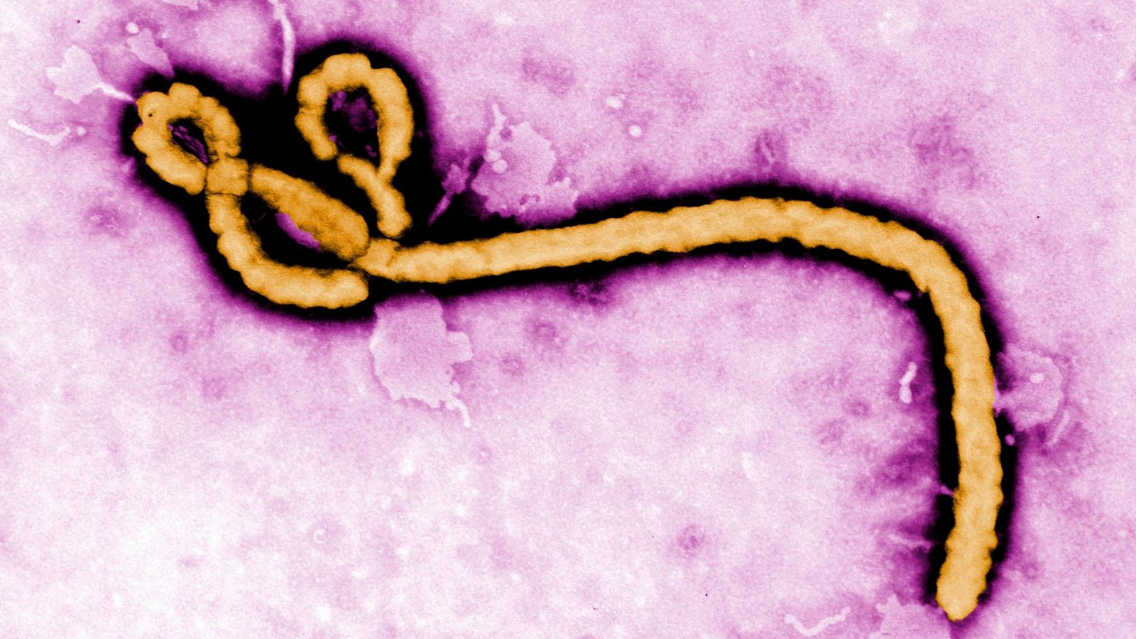 WHO declares Ebola outbreak a global health emergency: Here’s all you need to know about the virus