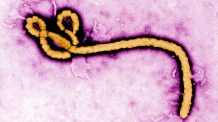 This undated colorized transmission electron micrograph file image made available by the Centers for Disease Control and Prevention (CDC) shows an Ebola virus virion. (AP)