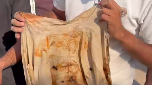 Rusted shirt of the minor taken out of the vehicle (Express Photo)