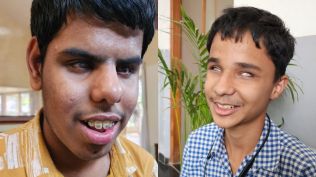 visually impaired students SSC exams without scribes