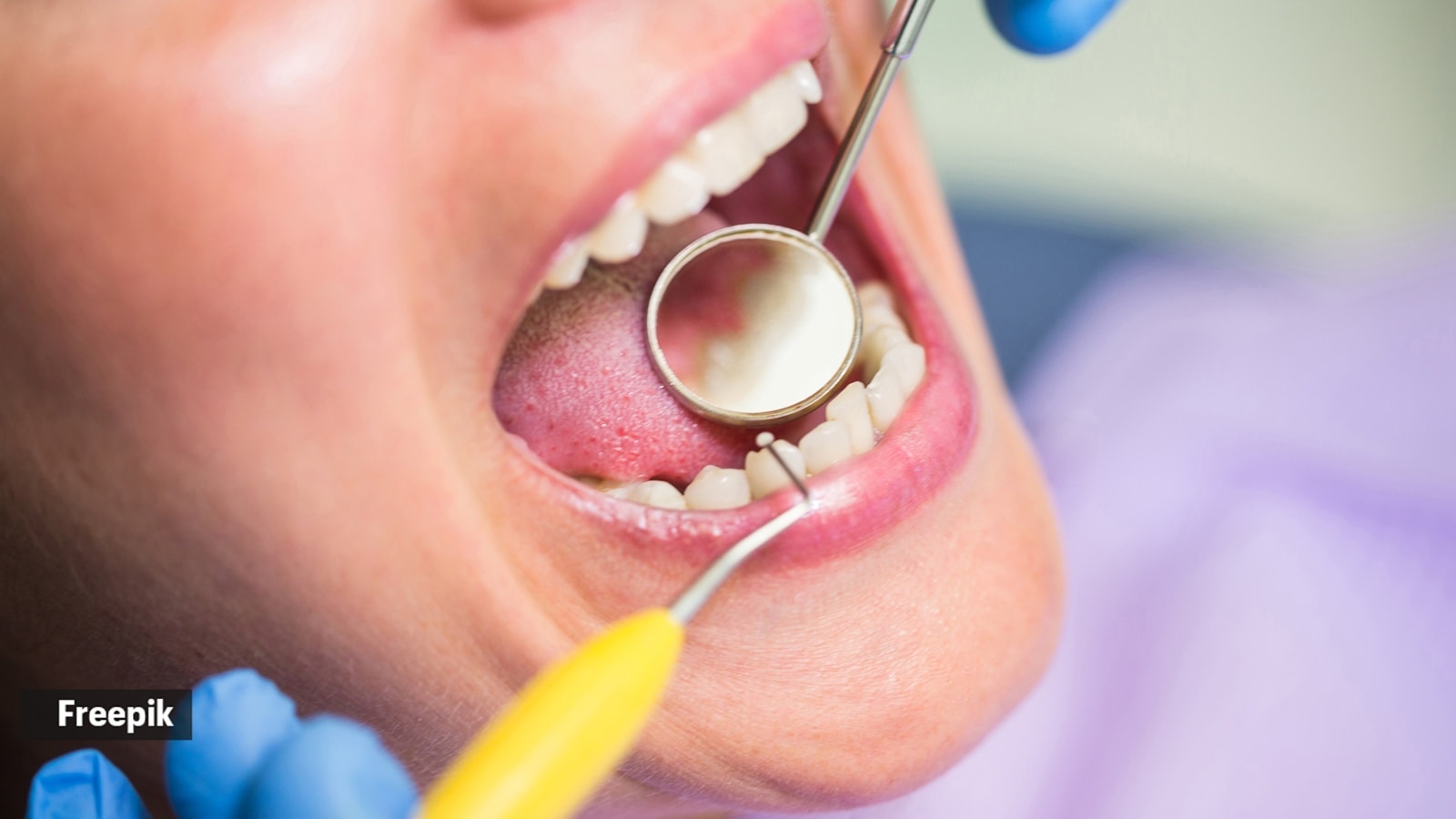oral cancer