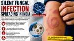 ringworm