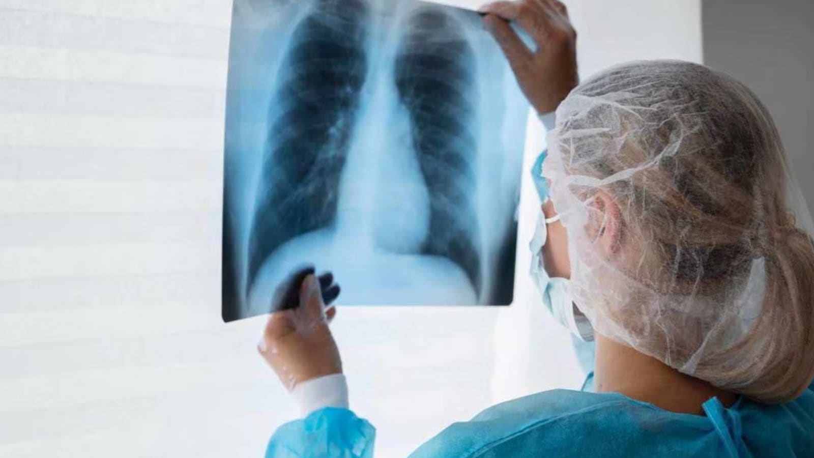 For months, doctors treated them for TB. They actually had lupus